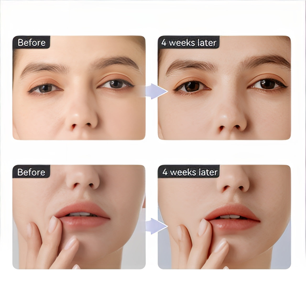 ANLAN Eye and Facial Beauty Device – Enhanced EMS Technology for Complete Skincare Experience